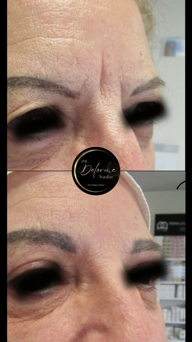 Les rides du lion (entre les sourcils) confèrent
...