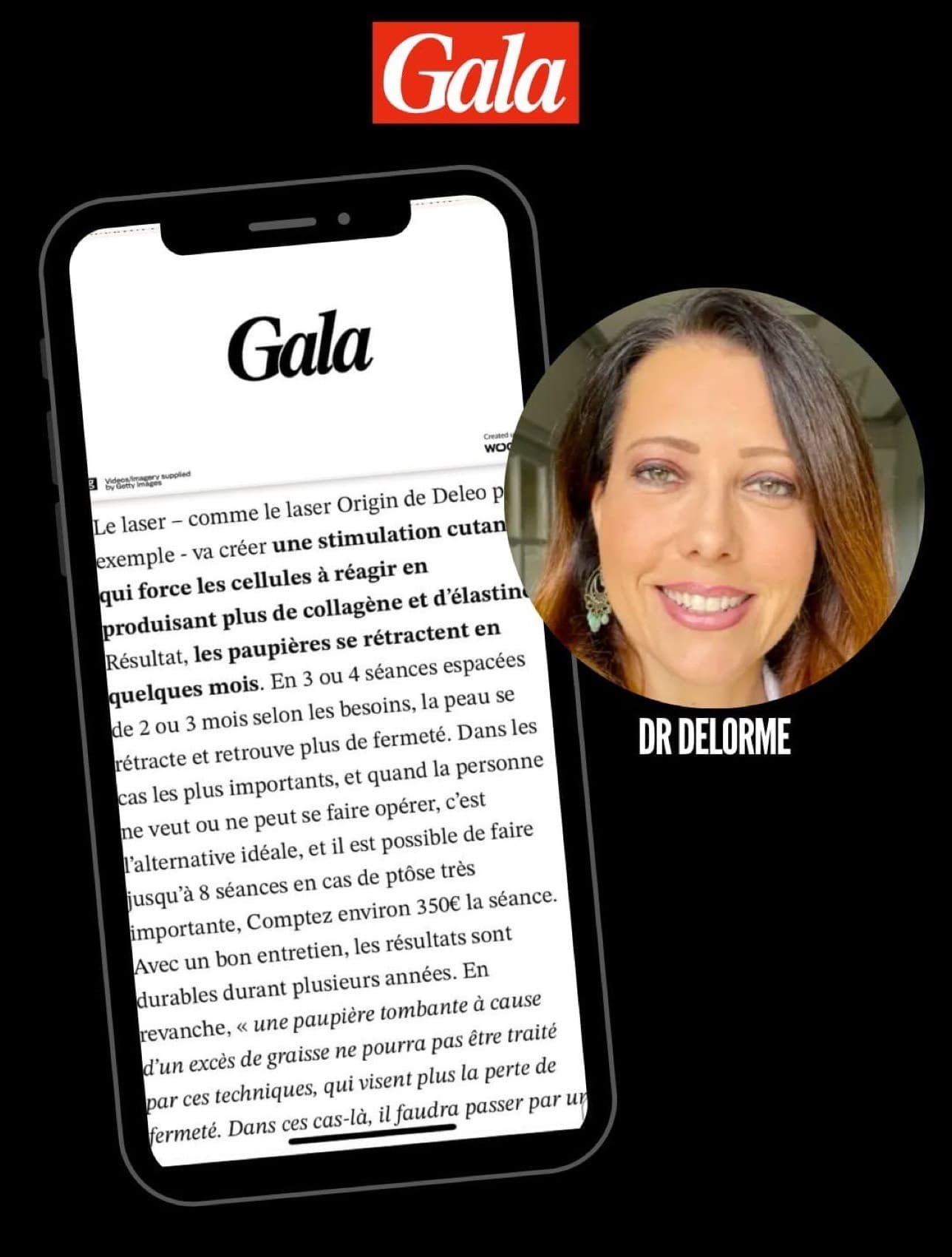 article gala paupieres tombantes dr delorme